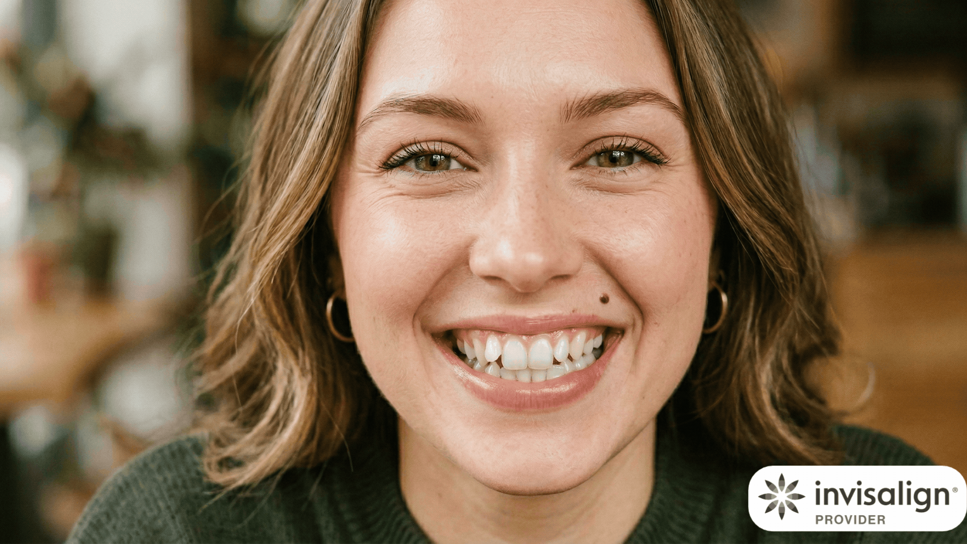 Invisalign smile simulation